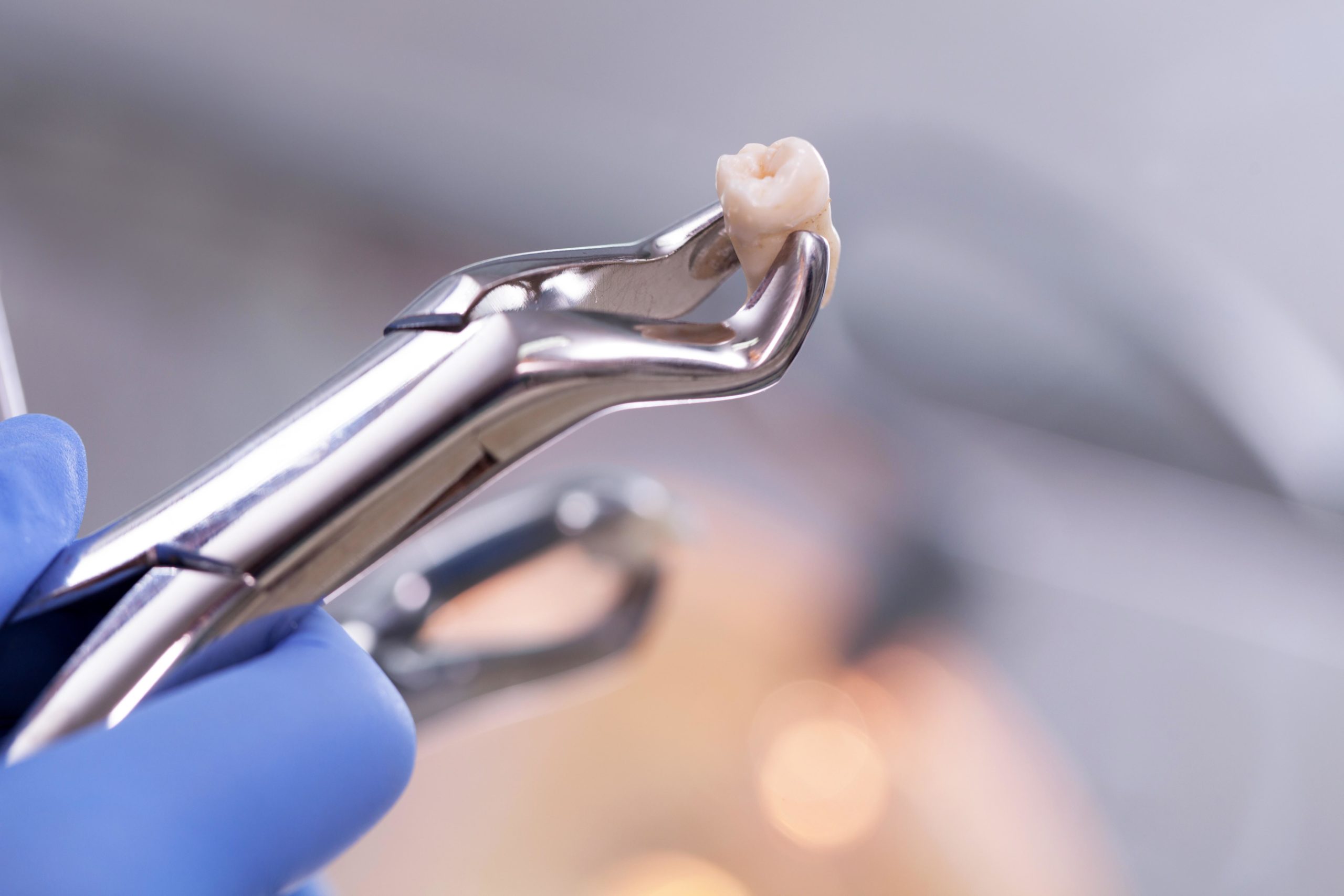 Haddon Oral Surgeons PA Wisdom Teeth Extraction NJ